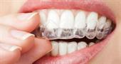 Отбеливание зубов перекисью водорода. Стоит ли?